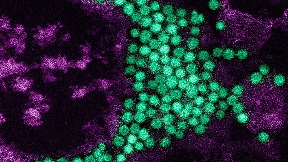 Micrografía electrónica coloreada de partículas esféricas del enterovirus D68