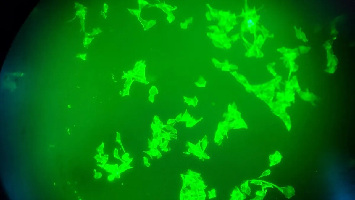 Microscopía de fluorescencia de células de cáncer oral con núcleos y citoesqueleto teñidos en colores